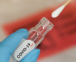 Covid-19, test diagnostici